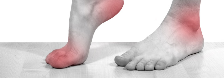 Chiropractic Kingston WA Foot Pain